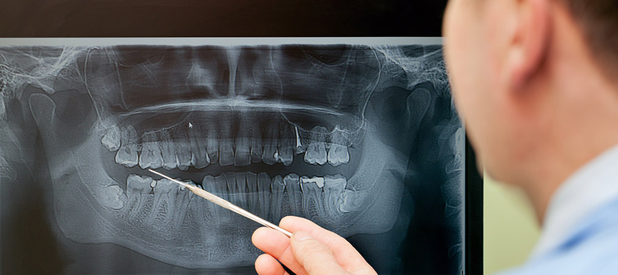 Рентген зубов в Хабаровске цена