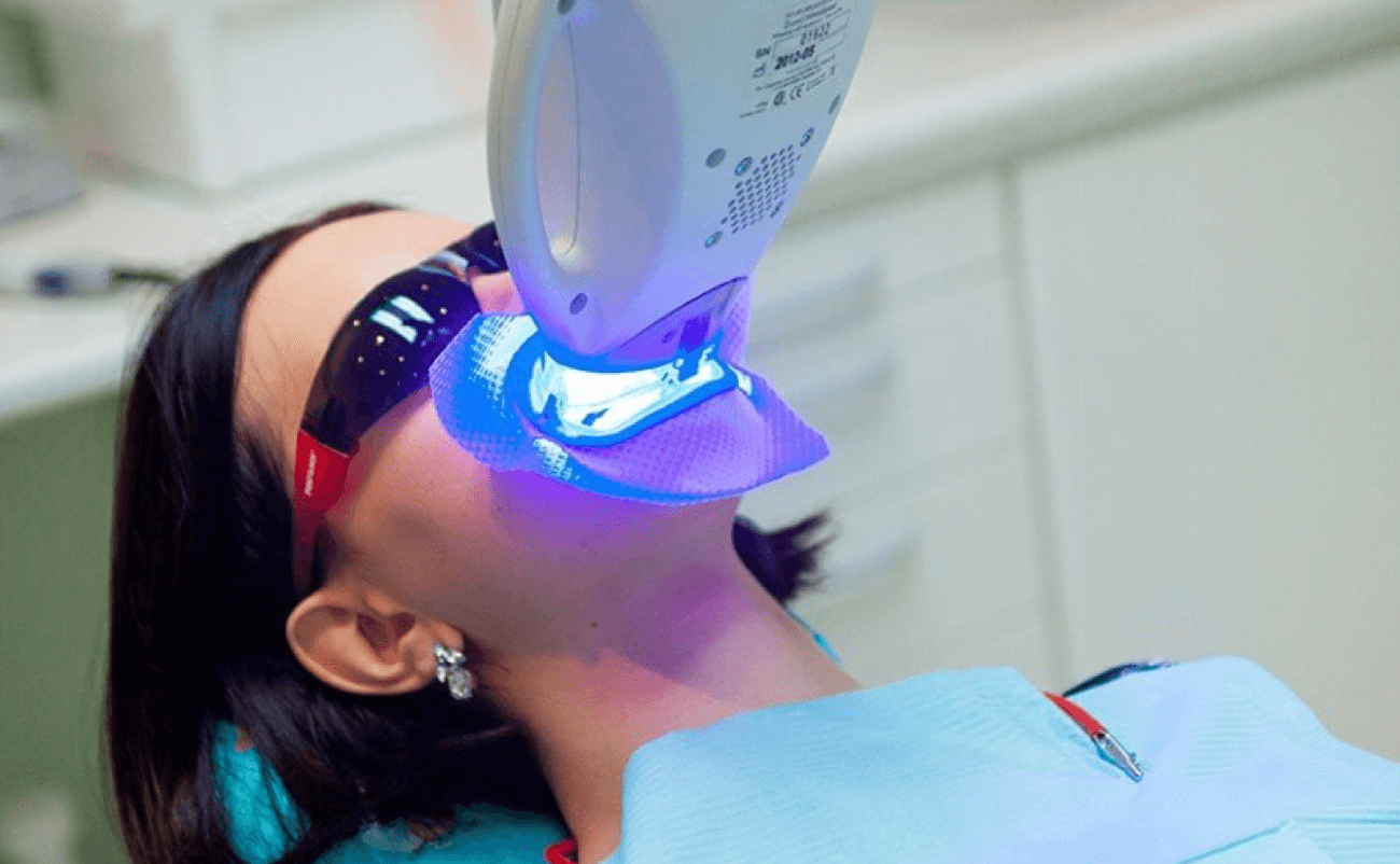 Отбеливание зубов ZOOM Томск Дамбовая мастердент детская стоматология томск