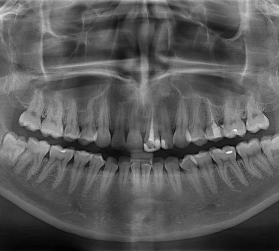 рентген зубов хабаровск