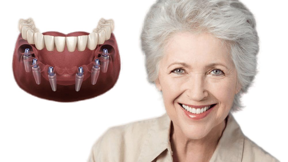рассрочка на протезирование зубов