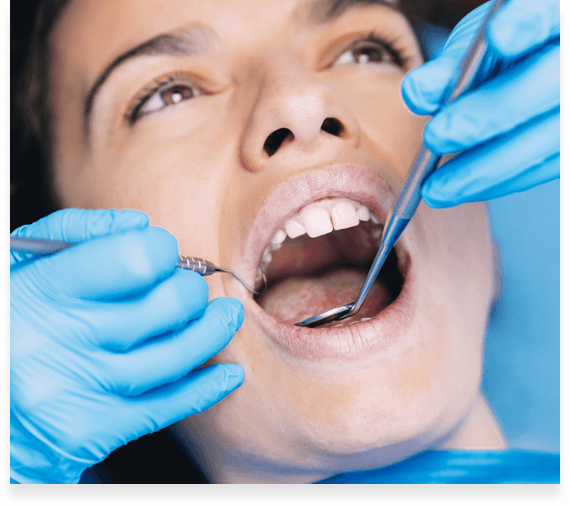 осложнения после удаления кисты зуба